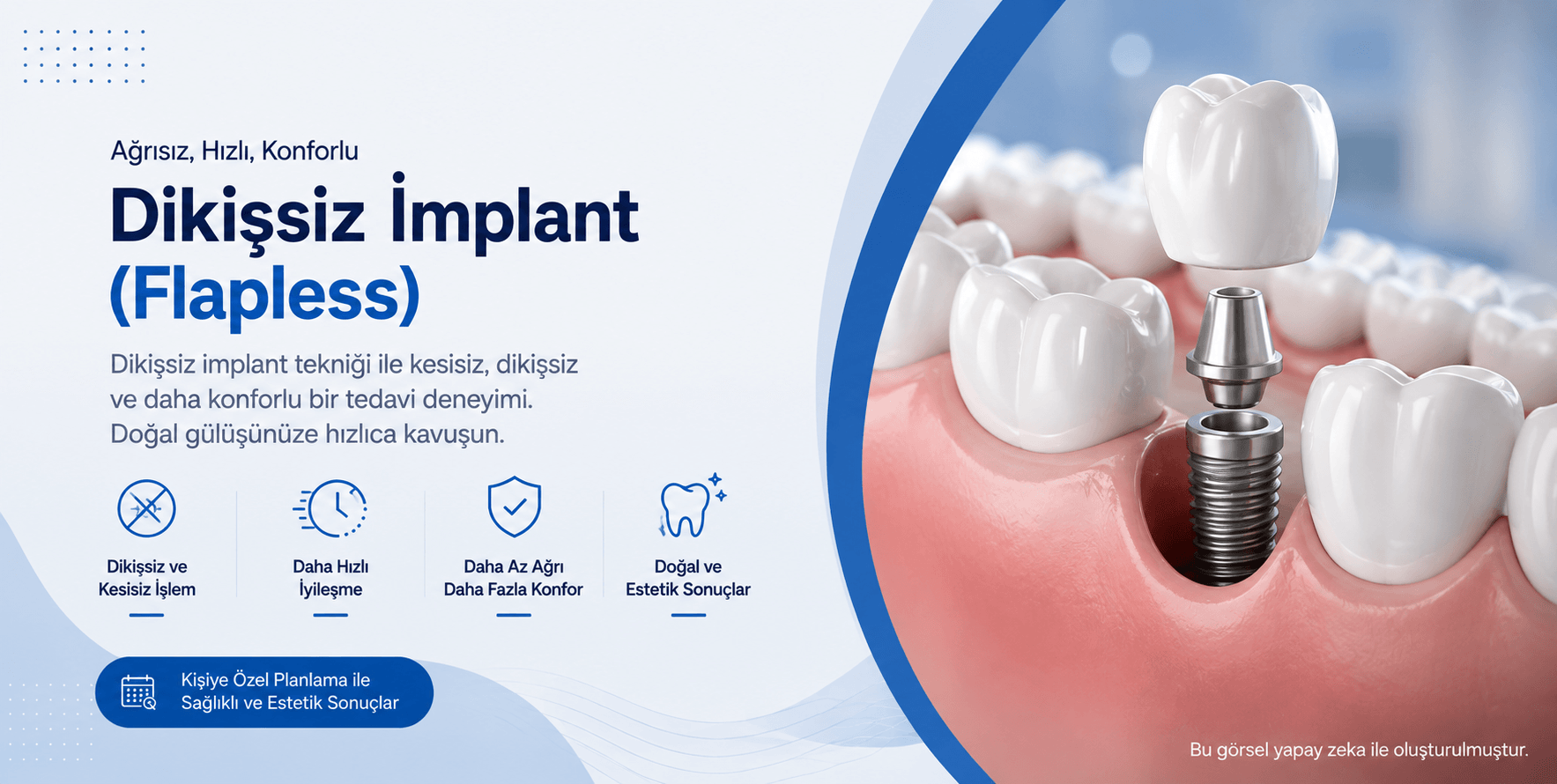 Dikişsiz İmplant (Flapless)